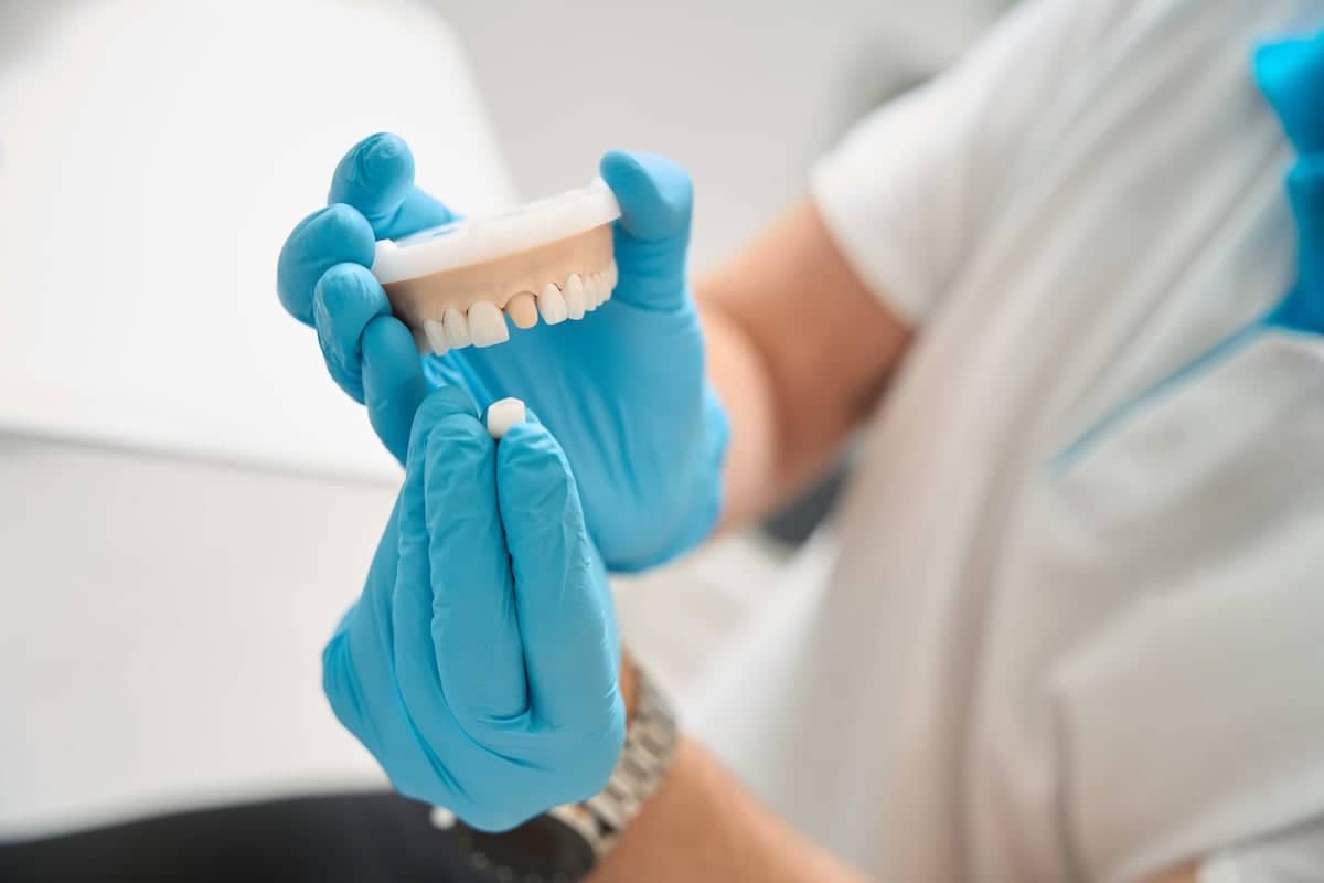 A dentist wearing blue gloves holds a dental mold in one hand and positions a single dental crown with the other hand, demonstrating dental work or tooth restoration.
