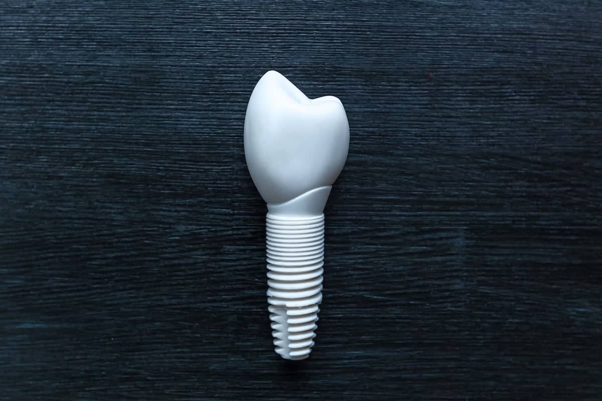 A single white dental implant with a tooth-shaped crown and ribbed screw base is placed upright on a dark textured surface.